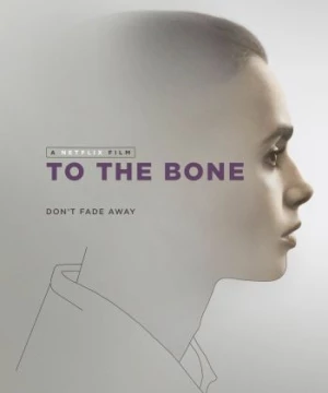 Da Bọc Xương (To the Bone) [2017]